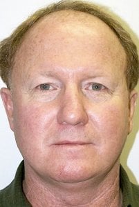 Before picture of man with hair loss Man looking down with bald spot on front of head